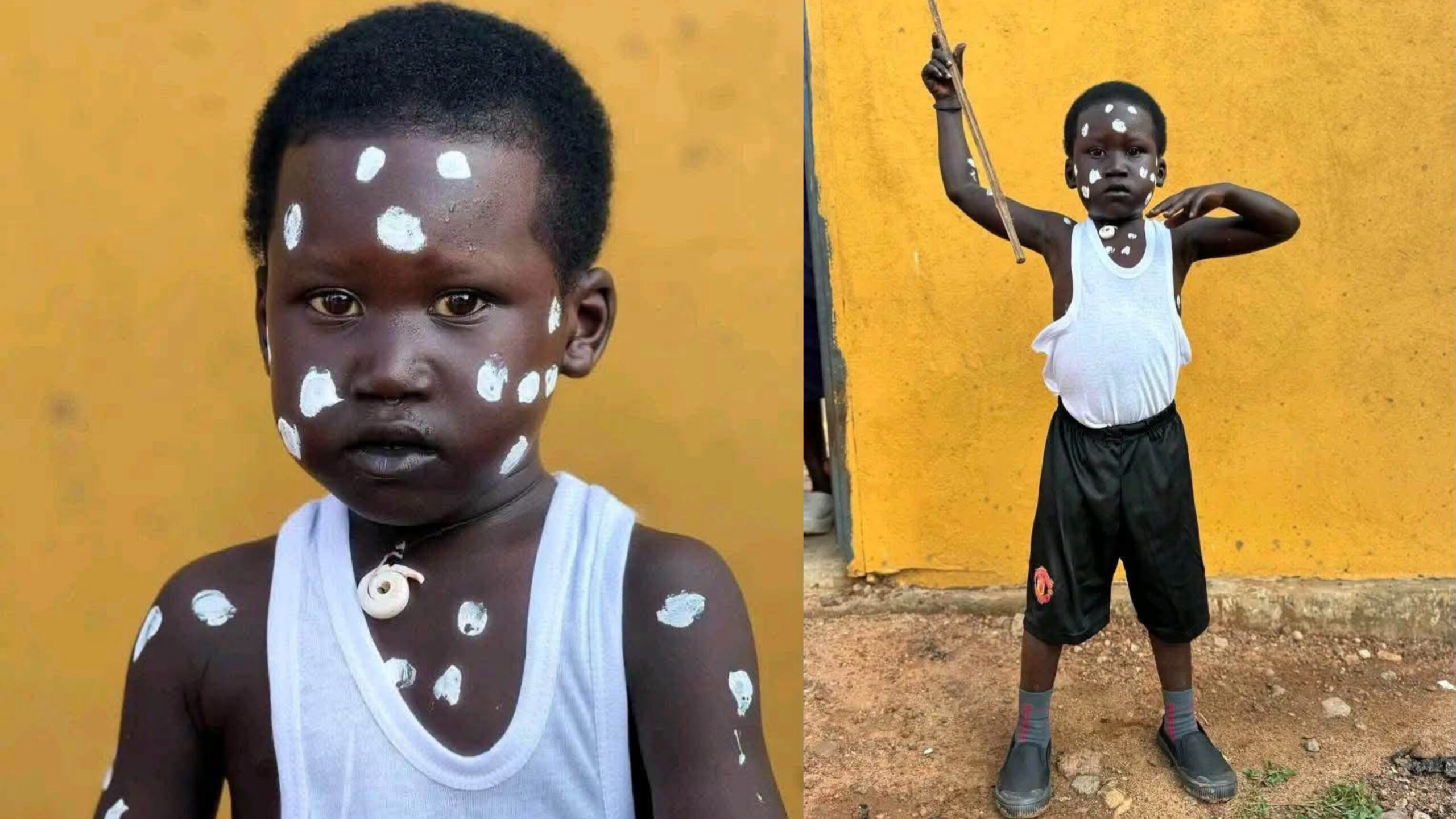 BREAKING: Young South Sudanese Cultural Dancer Chuol Receives Education Sponsorship After Winning Public Admiration BREAKING: Young South Sudanese Cultural Dancer Chuol Receives Education Sponsorship After Winning Public Admiration